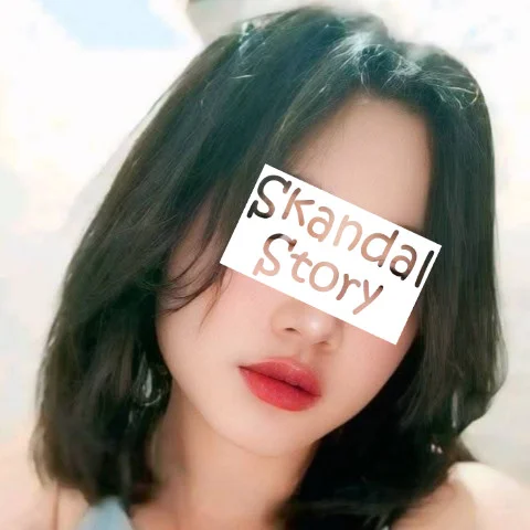 Skandal Story photo